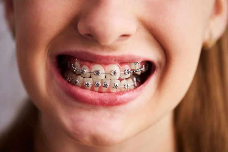 Girl showing her braces