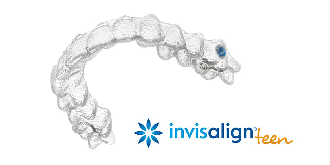 invisalign