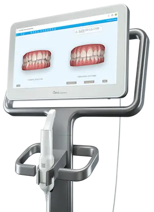 3D Intraoral Digital Scanner